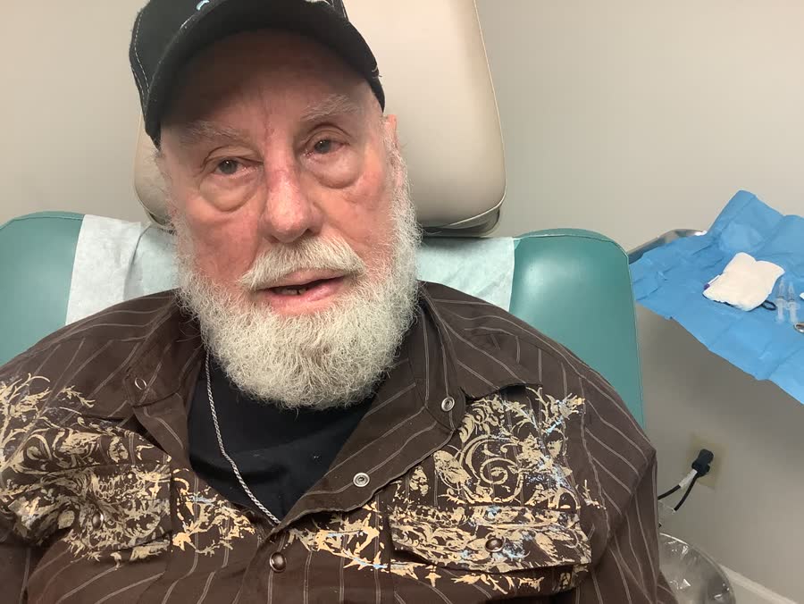 Mohs case 7 — Healed: squamous cell carcinoma on the nose
